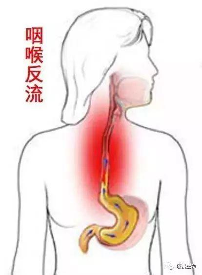 痉挛性发音障碍与肌紧张，语言功能的挑战及应对策略