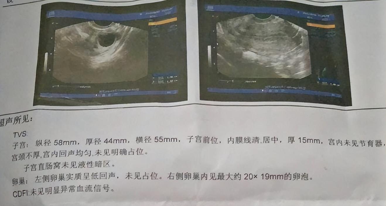 12岁女孩月经不调竟是癌症晚期