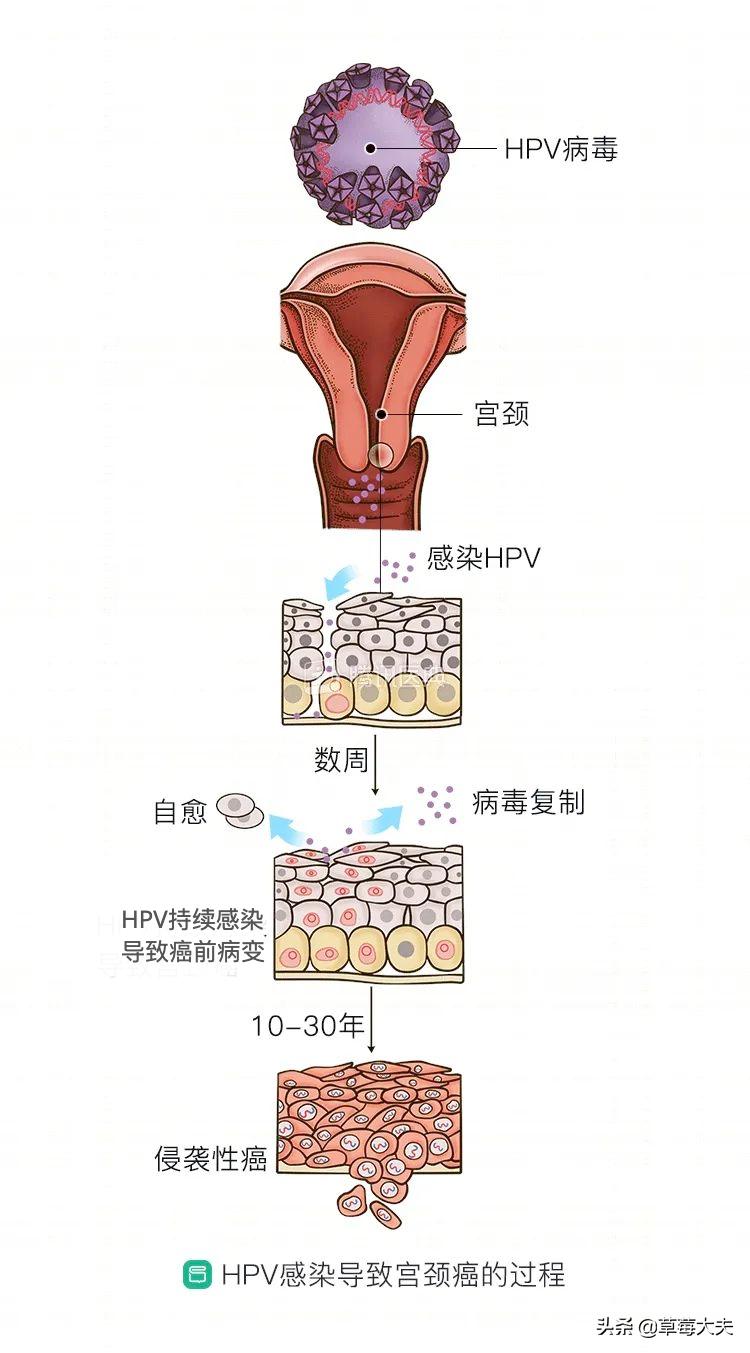 12岁女孩月经不调背后的惊人真相，癌症晚期的震撼觉醒故事