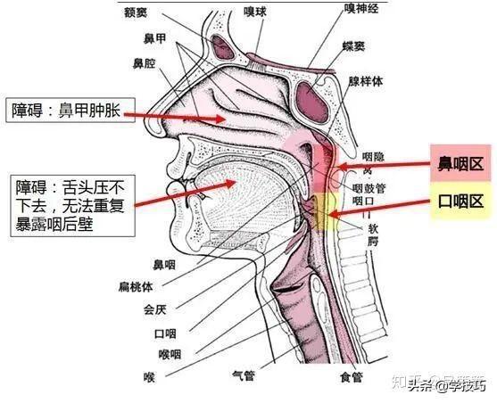 咽部知识误区全面解析，揭示不正确的叙述真相