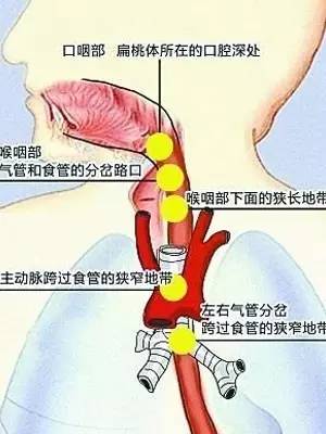 丧命式自救后，男子被巨大鱼刺直扎心脏